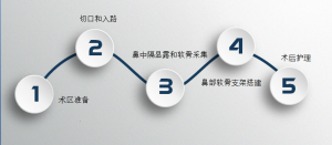 米扬丽格巫文云做一场综合鼻整形手术 你会经历哪些过程