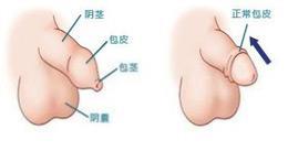 南阳协和医院医生怎样 优秀的团队技术水平高