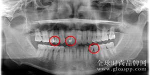 牙齿，需要仪式感