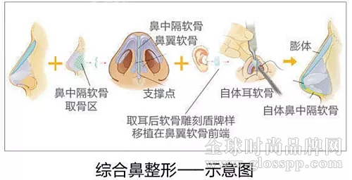 郑州集美整形鼻综合整形